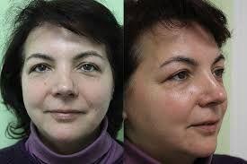 Фотография RV medical 3