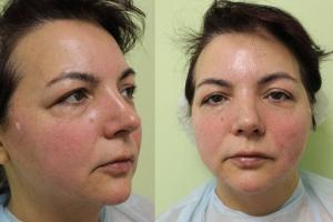 Фотография RV medical 2