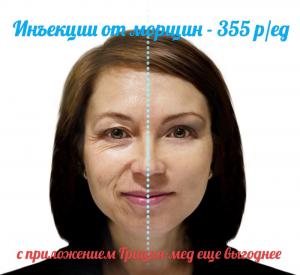 Фотография Грация-med 5