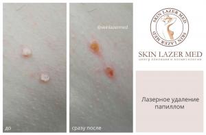 Фотография SkinLaserMed 0