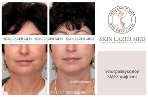 Фотография SkinLaserMed 2