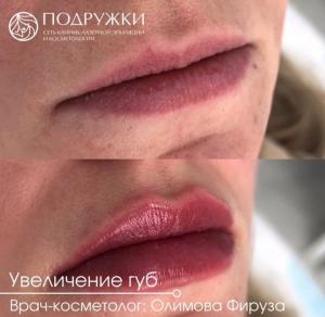 Фотография Подружки 5